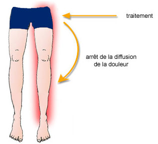 Douleurs jambes lourdes : un problème pas si anodin que ça